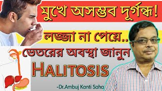 Halitosis permanent treatment  Bad smell  Bad breath  Fetor oris  home remedies and homeopathy [upl. by Cleopatra]