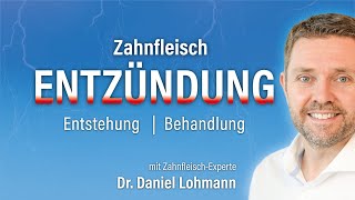 Zahnfleischentzündung Erfahren Sie hier wie Sie sich richtig verhalten [upl. by Paulette288]