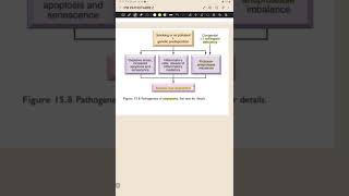 Pathogenesis of Emphysema [upl. by Nailliw]