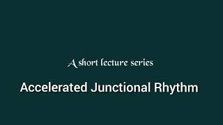 Accelerated Junctional Rhythm ECG ECG made easyAccelerated Junctional Rhythm [upl. by Orag290]