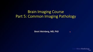 Brain imaging course – 5 – Common imaging pathology [upl. by Strickman42]