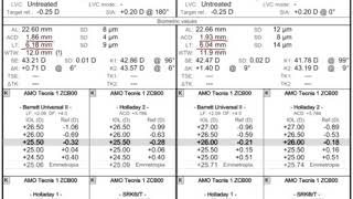 Biometry Analysis  Part A [upl. by Cassondra166]