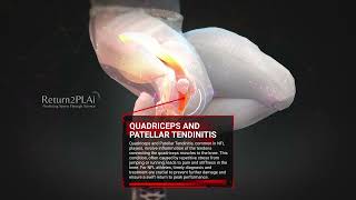 Quadriceps And Patellar Tendinitis [upl. by Abbe874]