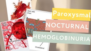 Paroxysmal Nocturnal Hemoglobinuria PNHDefinitionPathophysiologyTreatment [upl. by Angelita]