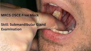 MRCS OSCE Free Mock  Skill Submandibular Gland Examination [upl. by Oap]