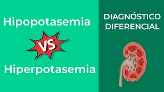 Diagnostico Diferencial Hipopotasemia vs Hiperpotasemia [upl. by Alegnatal183]