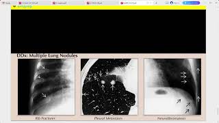 RADIOLOGY EXAM CASES [upl. by Spencer]