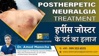 Postherpetic Neuralgia PHN Treatment  हर्पीस जोस्टर के दर्द का इलाज।by Dr Amod Manocha [upl. by Aiym]