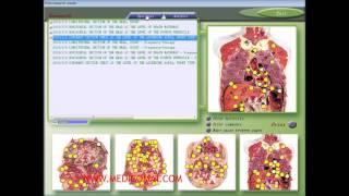 7DNLS Bioresonance NLS Diagnosis and Treatment PRINT MEDICOMAT36 [upl. by Karb]