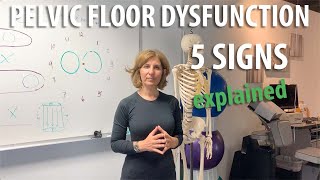 5 signs of Pelvic Floor Dysfunction explained by Core Pelvic Floor Therapy Doctor [upl. by Anoid]