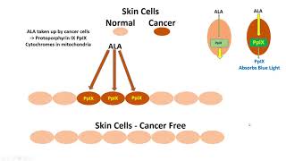 Photodynamic Therapy [upl. by Newmark]