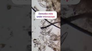 mite under microscope mite canine demodicosis [upl. by Magdau]