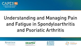 Understanding and Managing Pain and Fatigue in Spondyloarthritis and Psoriatic Arthritis [upl. by Krishna]