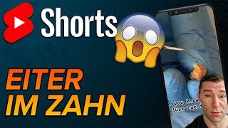 Zyste am Zahn shorts [upl. by Ainegul]