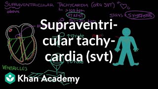 Supraventricular tachycardia SVT  Circulatory System and Disease  NCLEXRN  Khan Academy [upl. by Enasus]