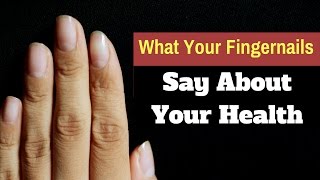 What Your Fingernails Say About Your Health [upl. by Dikmen]