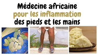 Médecine africaine pour les inflammation des pieds et les mains [upl. by Eignav735]