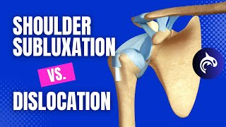 Shoulder Subluxation vs Shoulder Dislocation  Shohei Ohtani Injury 3D animation [upl. by Nainatrad22]