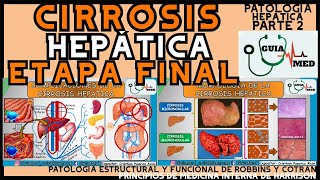 CIRROSIS HEPÁTICA ETAPA FINAL  GuiaMed [upl. by Hsak]