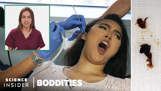 Doctor Explains Earwax Removal  Boddities [upl. by Eerased]