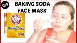 BAKING SODA FACE MASK  ACNE [upl. by Eihpos24]