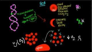 Pathophysiology of Sickle Cell Anemia [upl. by Erdnuaed]