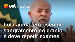 Lula ainda tem risco de sangramento no crânio após queda e deve repetir exames dizem médicos [upl. by Hola]