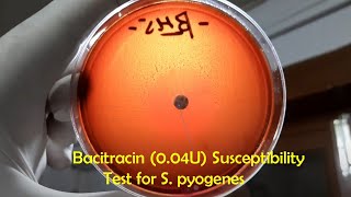 Bacitracin Sensitive Betahaemolytic Streptococci Streptococcus pyogenes [upl. by Damour]