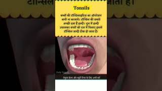 Tonsils Home Remedies For Easy Tips 🤗 [upl. by Ainna]