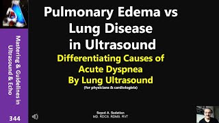 Pulmonary Edema vs Lung Disease in US Differentiating Causes of Acute Dyspnea By Lung Ultrasound [upl. by Anoy]