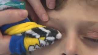 How to clean the eyelids in children and babies [upl. by Madid]