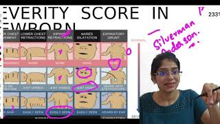 NEONATOLOGY PART 2  NEET PGFMGE  MALAYALAM [upl. by Anabelle250]