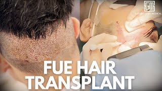 What To Expect During a Hair Transplant  Stepbystep Procedure  Seoul Guide Medical [upl. by Aisayt]