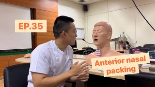 EP 35  Anterior nasal packing การใช้วัสดุกดห้ามเลือดในโพรงจมูกด้านหน้า [upl. by Siddon958]