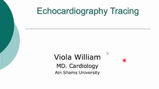 Echocardiography Tracing DrViola wiliams [upl. by Akirahs]