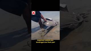 EFEK SENGATAN DURI IKAN PARI 😱😭 ikanpari [upl. by Hercules]