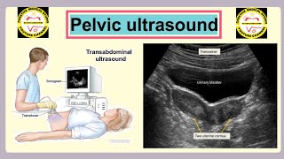 Pelvis Ultrasound  Urinary bladder and Uterus Ultrasound technique [upl. by Adnahsat]