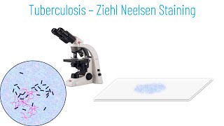 Ziehl Neelsen Staining Principle and Procedure [upl. by Ridinger]