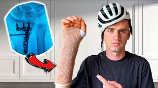 I fell off my Bike and broke my Wrist [upl. by Sallyann120]