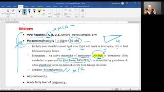 Acute l Fulminant l hepatic failure FHF [upl. by Seitz]