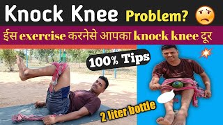 Knock Knee Problem Solution  Knock Knee kaise thik kare only 1 exercise करनेसे आपका Knock knee दूर [upl. by Gibbeon]