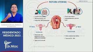 Obstetricia  10 Hemorragia obstetrica II mitad [upl. by Nowd]