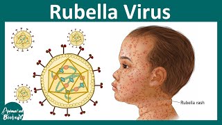 Rubella  German Measles  Rubella virus  pathogenesis diagnosis and treatment of Rubella [upl. by Olotrab950]