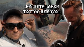 Jon Nelson Gets Laser Tattoo Removal [upl. by Yerfej]