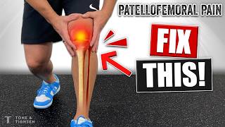 Fix Your Kneecap Pain Exercises For Patellofemoral Syndrome [upl. by Llerod]