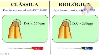 Módulo II  Aula 4 Técnica Obturação [upl. by Reema8]