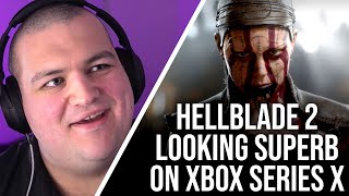 Hellblade 2s Latest Trailer Series X Footage Looks Excellent [upl. by Htepsle234]