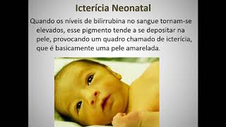 Aula 2 2ºTRI  Neonatologia Icterícia [upl. by Francisco643]