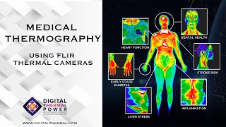 Medical Thermography using FLIR Thermal Camera [upl. by Kcirdahc]