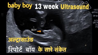 13 Week  Ultrasound Showing baby boy  Gender Ultrasound  Full video  Uk [upl. by Zachery498]